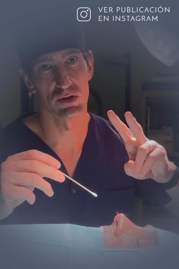 Dos rinoplastias fallidas