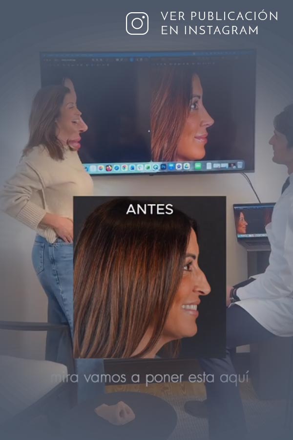 Paciente se opera influenciada por la simulación, esta es su reacción